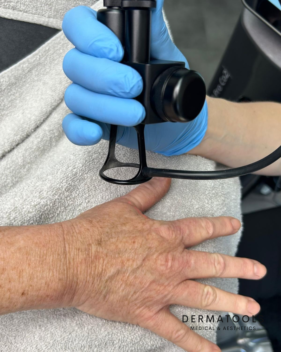 Fractional X Pro co2 Laser