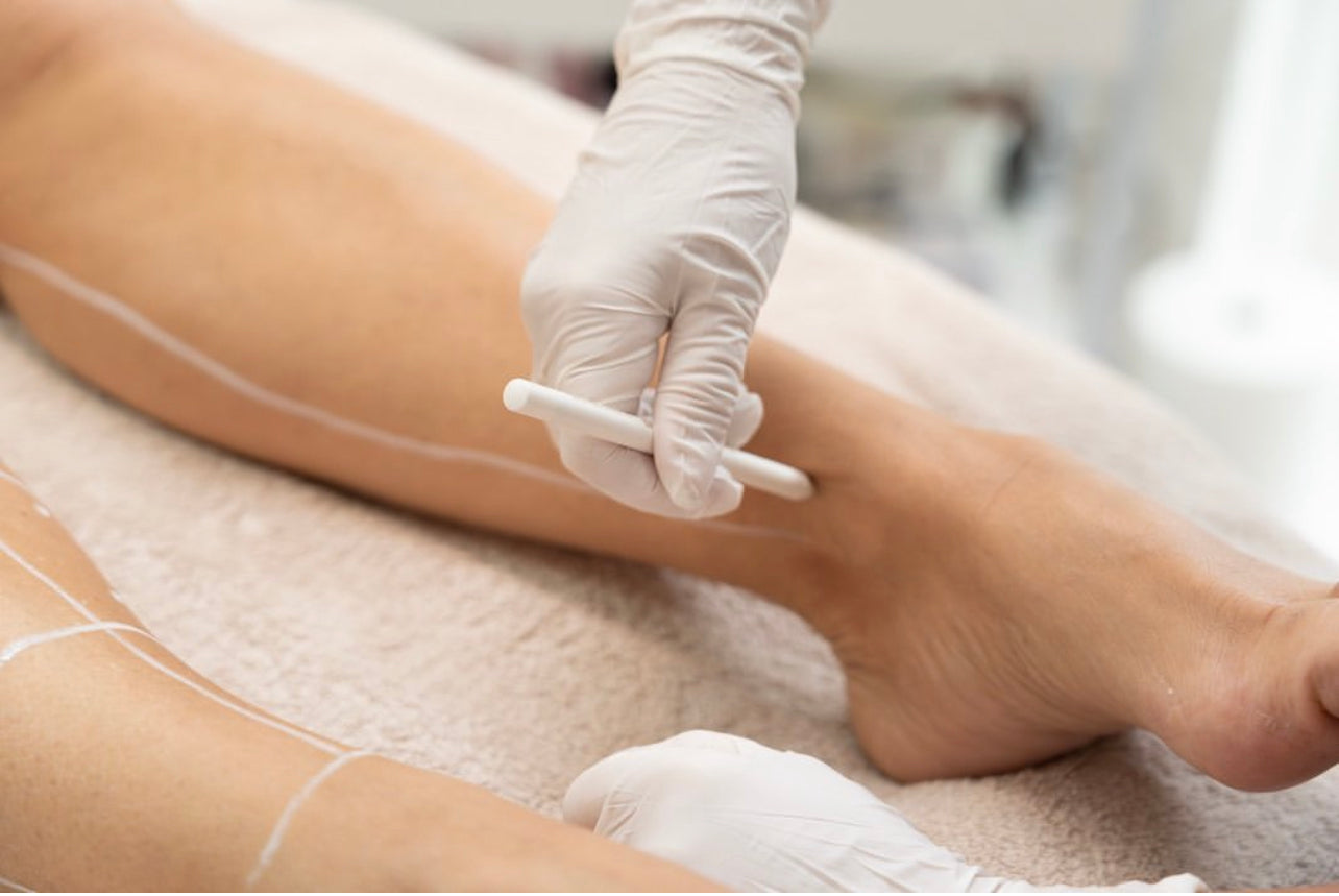 Diode laser ontharing Allround