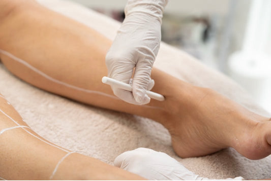 Diode laser ontharing Allround