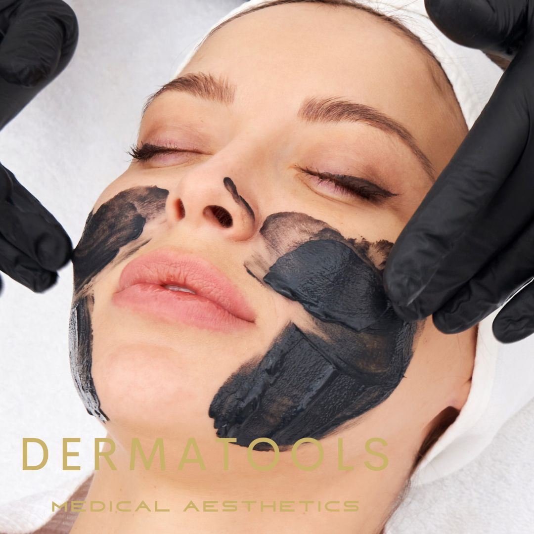 Privé opleiding Tatoeage Verwijderen + Carbon laser peeling ( 2 dagen )