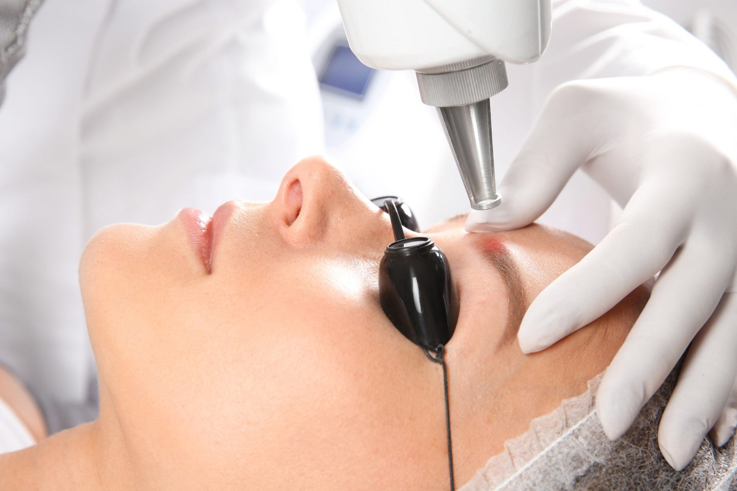 Privé opleiding Tatoeage Verwijderen + Carbon laser peeling ( 2 dagen )